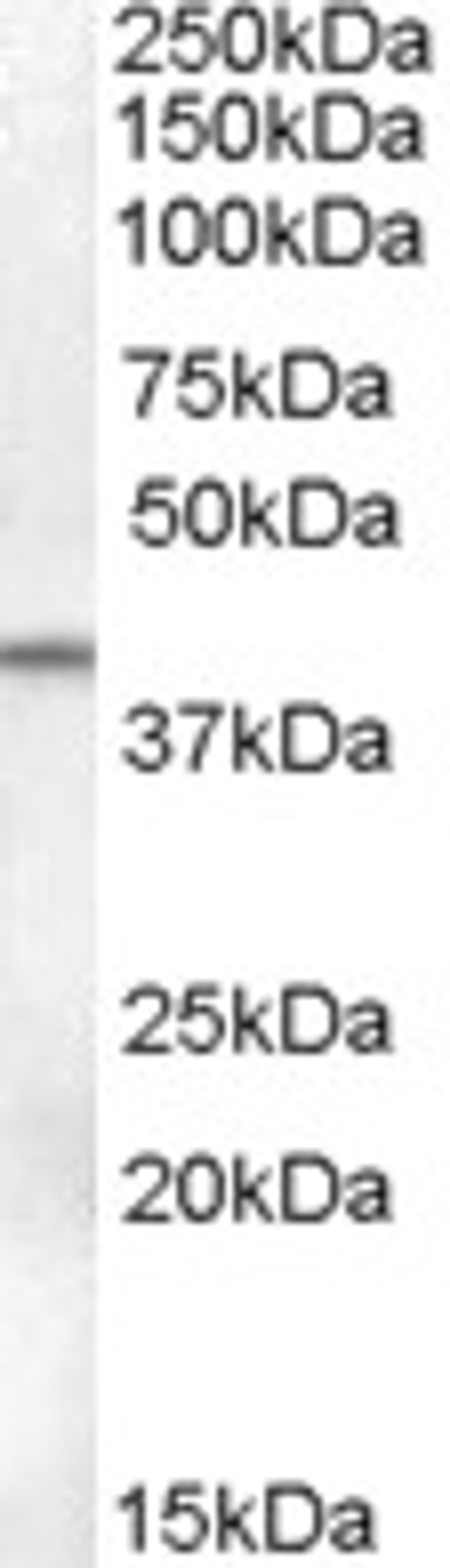 46-358 (0.1ug/ml) staining of Human Ovary lysate (35ug protein in RIPA buffer). Primary incubation was 1 hour. Detected by chemiluminescence.