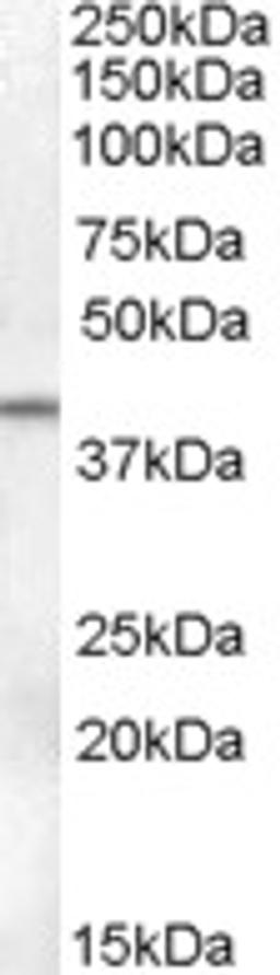 46-358 (0.1ug/ml) staining of Human Ovary lysate (35ug protein in RIPA buffer). Primary incubation was 1 hour. Detected by chemiluminescence.