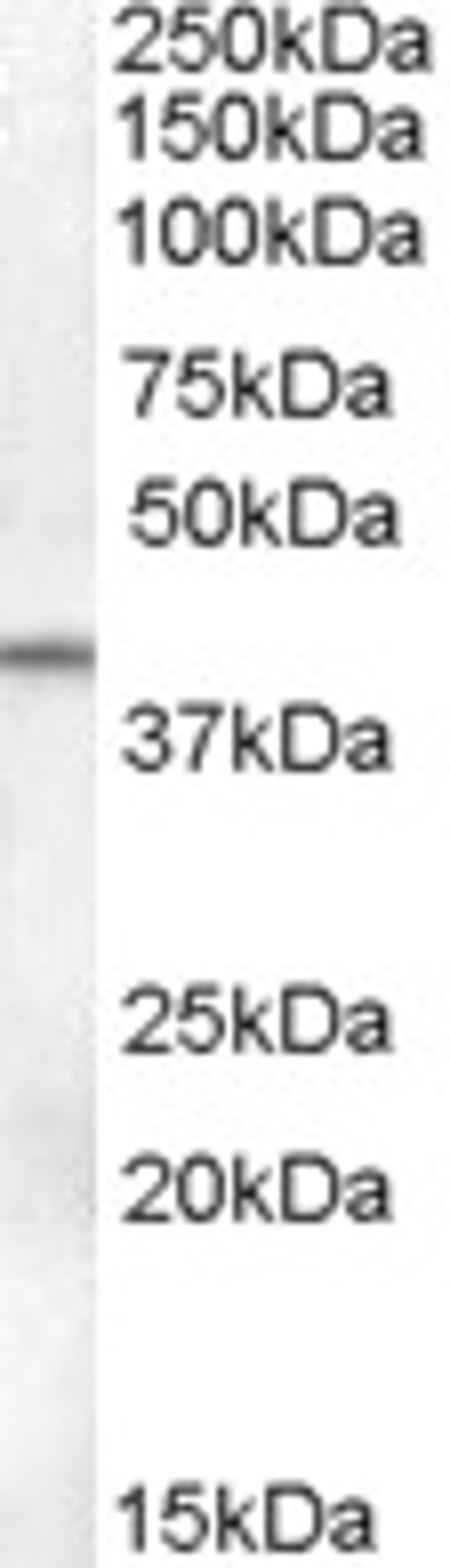 46-358 (0.1ug/ml) staining of Human Ovary lysate (35ug protein in RIPA buffer). Primary incubation was 1 hour. Detected by chemiluminescence.