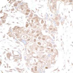 Detection of human p300 by immunohistochemistry.