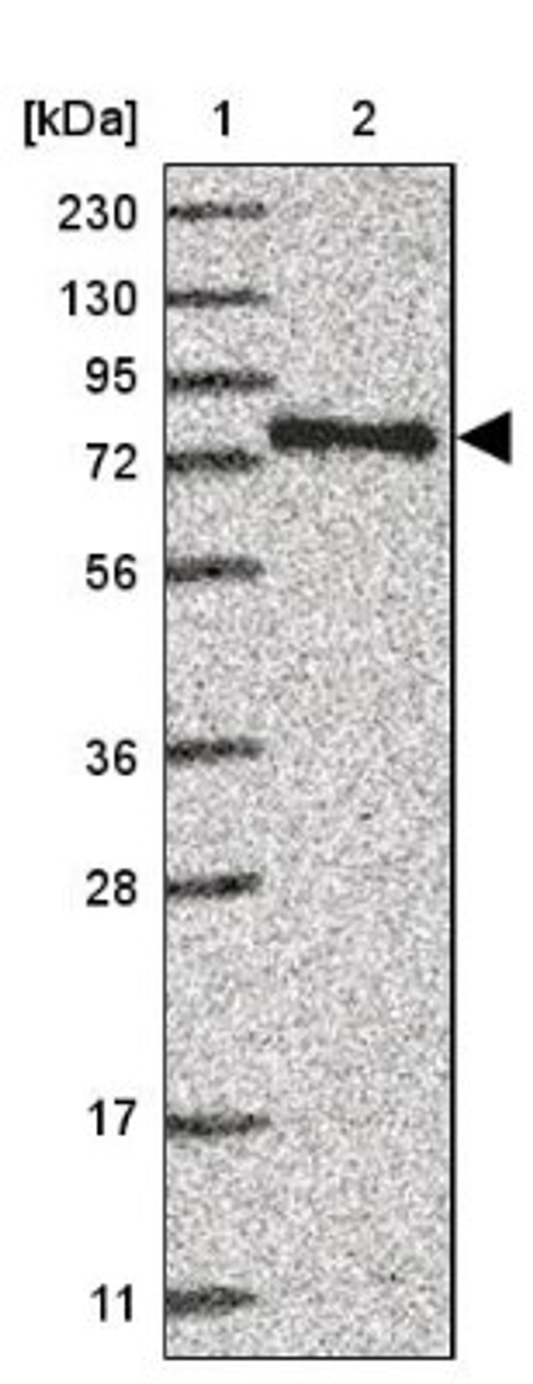 Western Blot: ZNF198 Antibody [NBP1-84685] - Lane 1: Marker [kDa] 230, 130, 95, 72, 56, 36, 28, 17, 11<br/>Lane 2: Human cell line RT-4