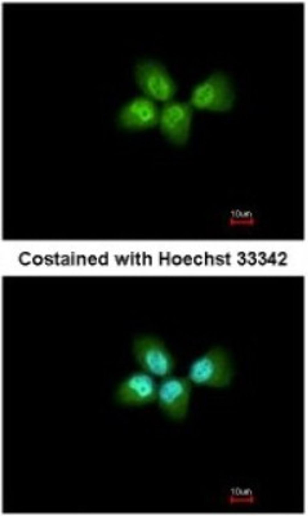 Immunocytochemistry/Immunofluorescence: ANP32A Antibody [NBP2-15412] - Paraformaldehyde-fixed A431, using antibody at 1:200 dilution.