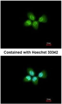 Immunocytochemistry/Immunofluorescence: ANP32A Antibody [NBP2-15412] - Paraformaldehyde-fixed A431, using antibody at 1:200 dilution.