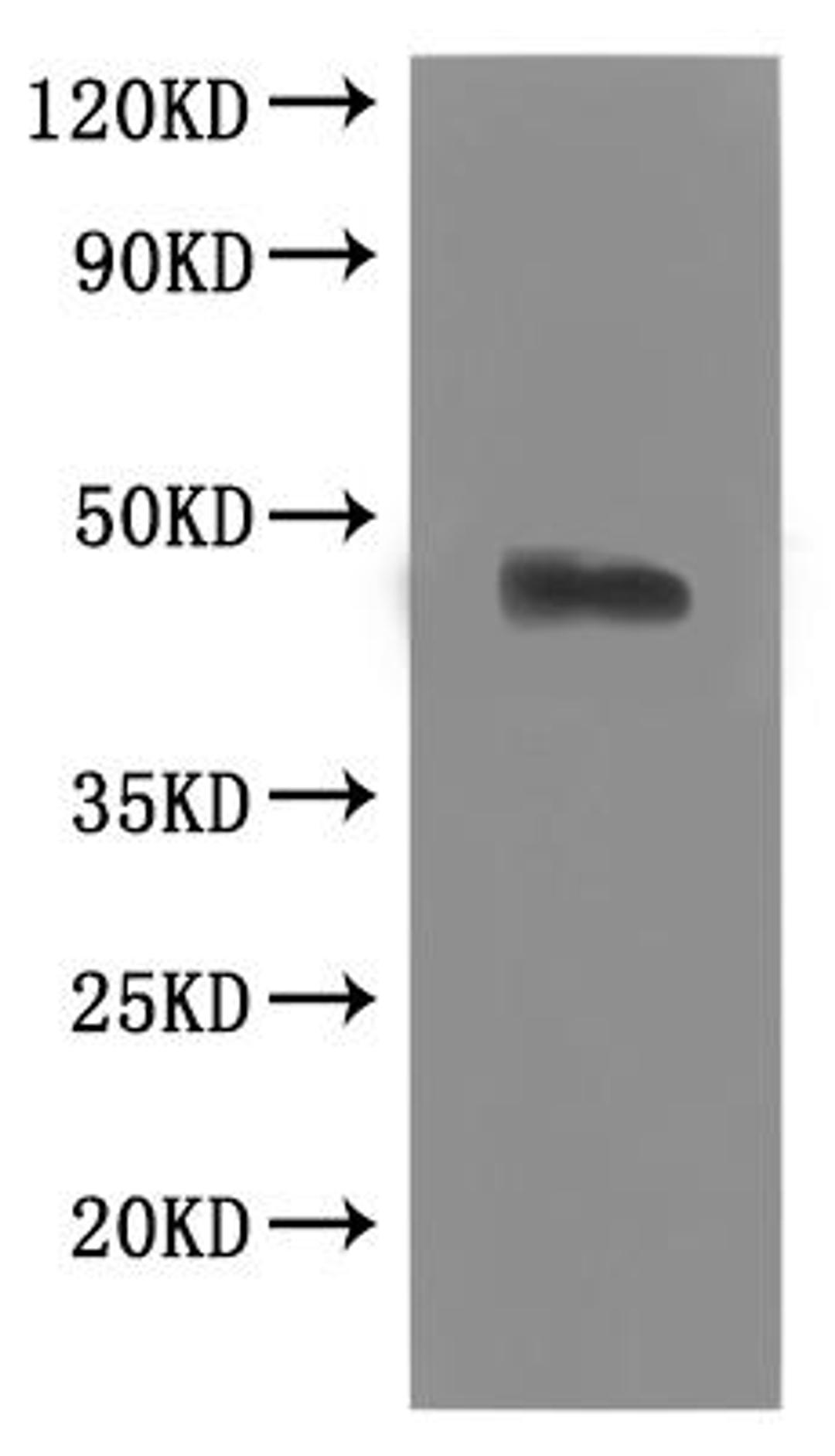 CSB-MP004847MOW is detected by Mouse anti-6*His monoclonal antibody.