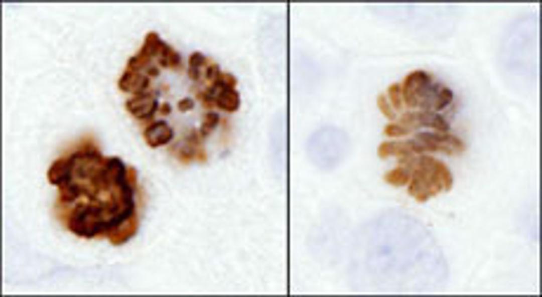 Detection of human and mouse Histone H3 (S10) by immunohistochemistry.