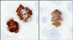 Detection of human and mouse Histone H3 (S10) by immunohistochemistry.