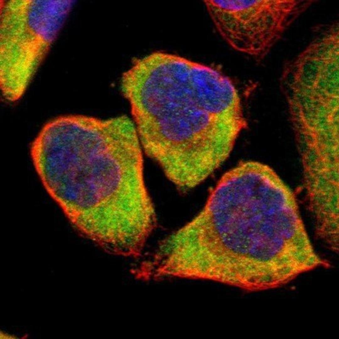 Immunocytochemistry/Immunofluorescence: CLIC4 Antibody [NBP1-85574] - Staining of human cell line A-431 shows positivity in cytoplasm.