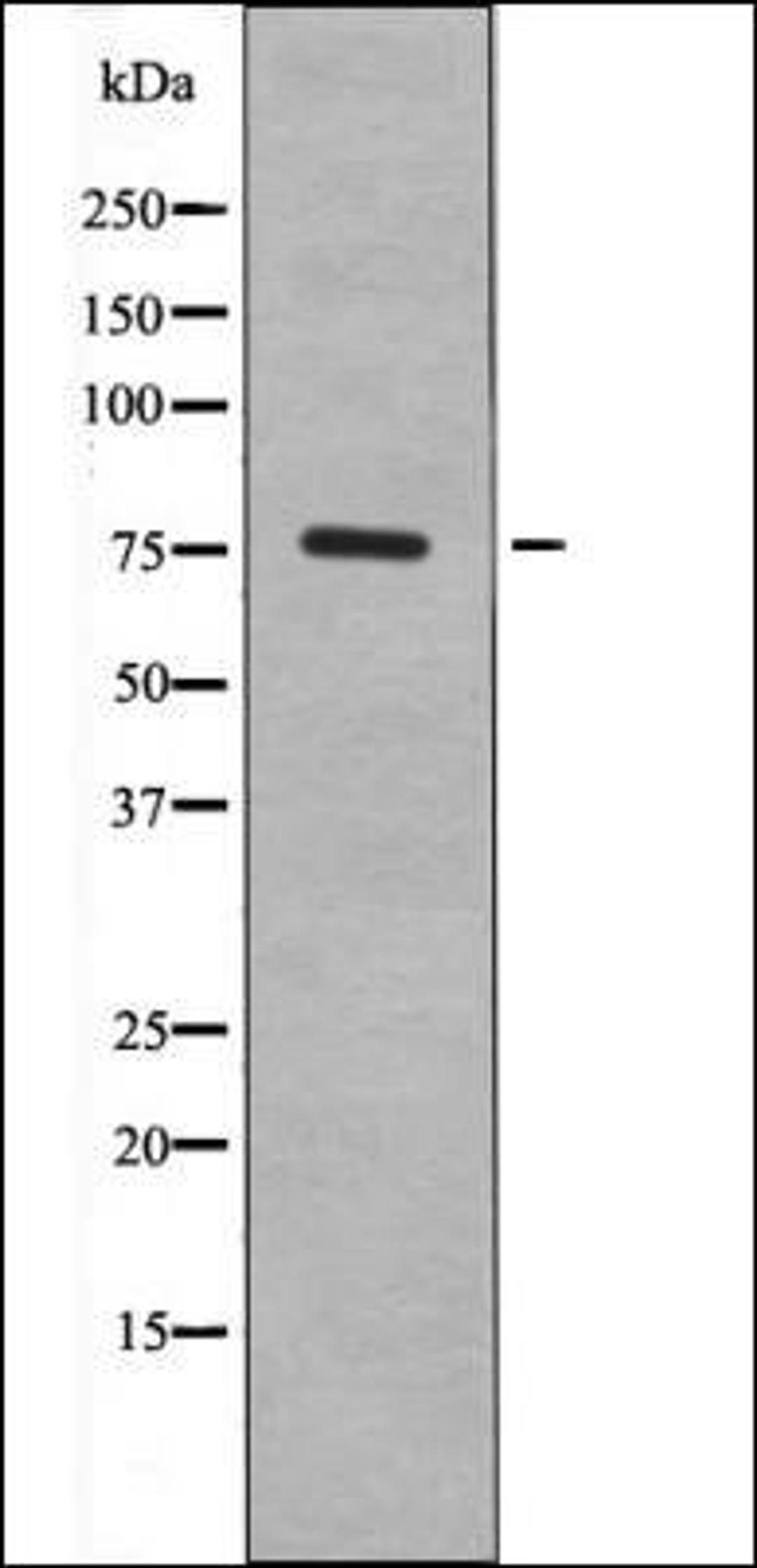 Western blot analysis of HepG2 whole cell lysates using FKHR -Phospho-Ser249- antibody