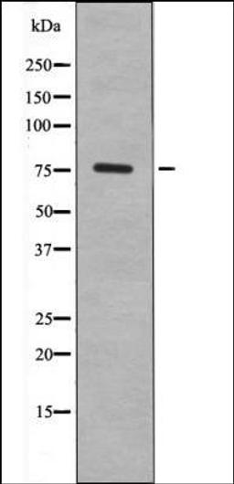 Western blot analysis of HepG2 whole cell lysates using FKHR -Phospho-Ser249- antibody