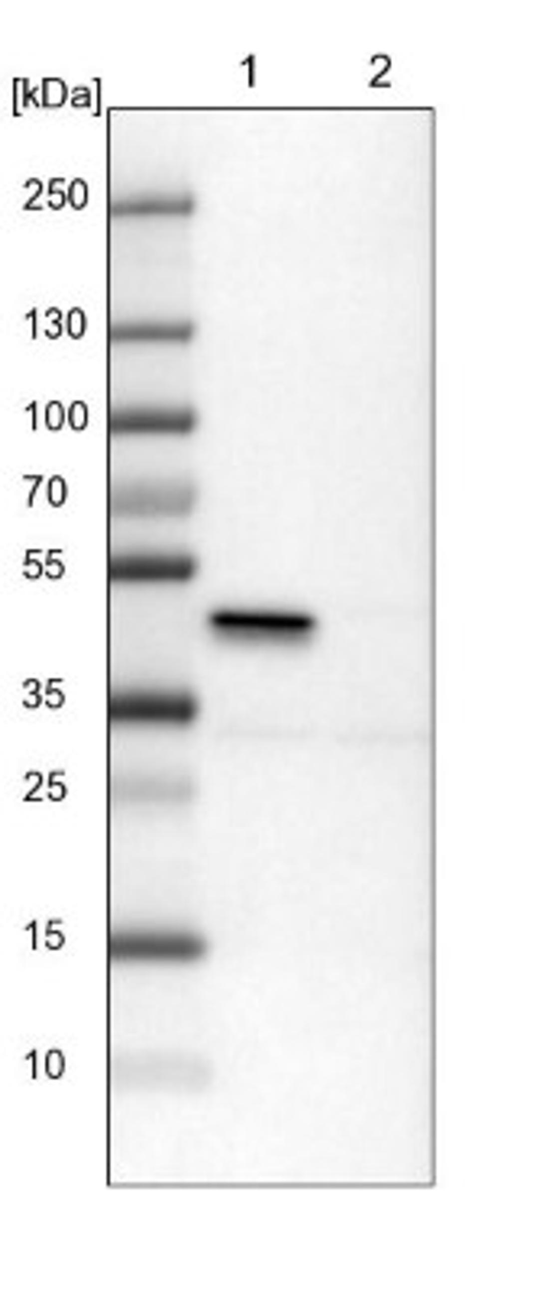 Western Blot: ILKAP/PP2C delta Antibody [NBP1-85117] - Lane 1: NIH-3T3 cell lysate (Mouse embryonic fibroblast cells)<br/>Lane 2: NBT-II cell lysate (Rat Wistar bladder tumour cells)