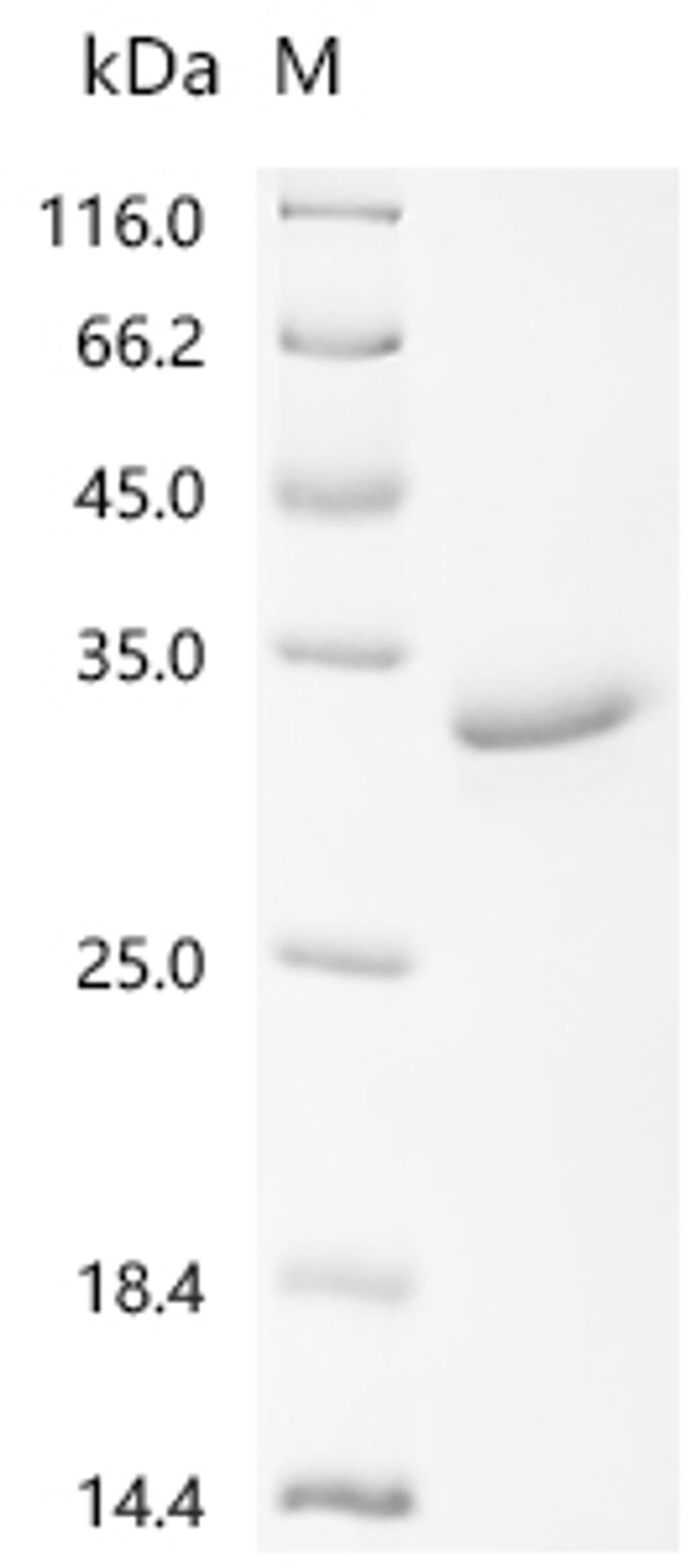 (Tris-Glycine gel) Discontinuous SDS-PAGE (reduced) with 5% enrichment gel and 15% separation gel.