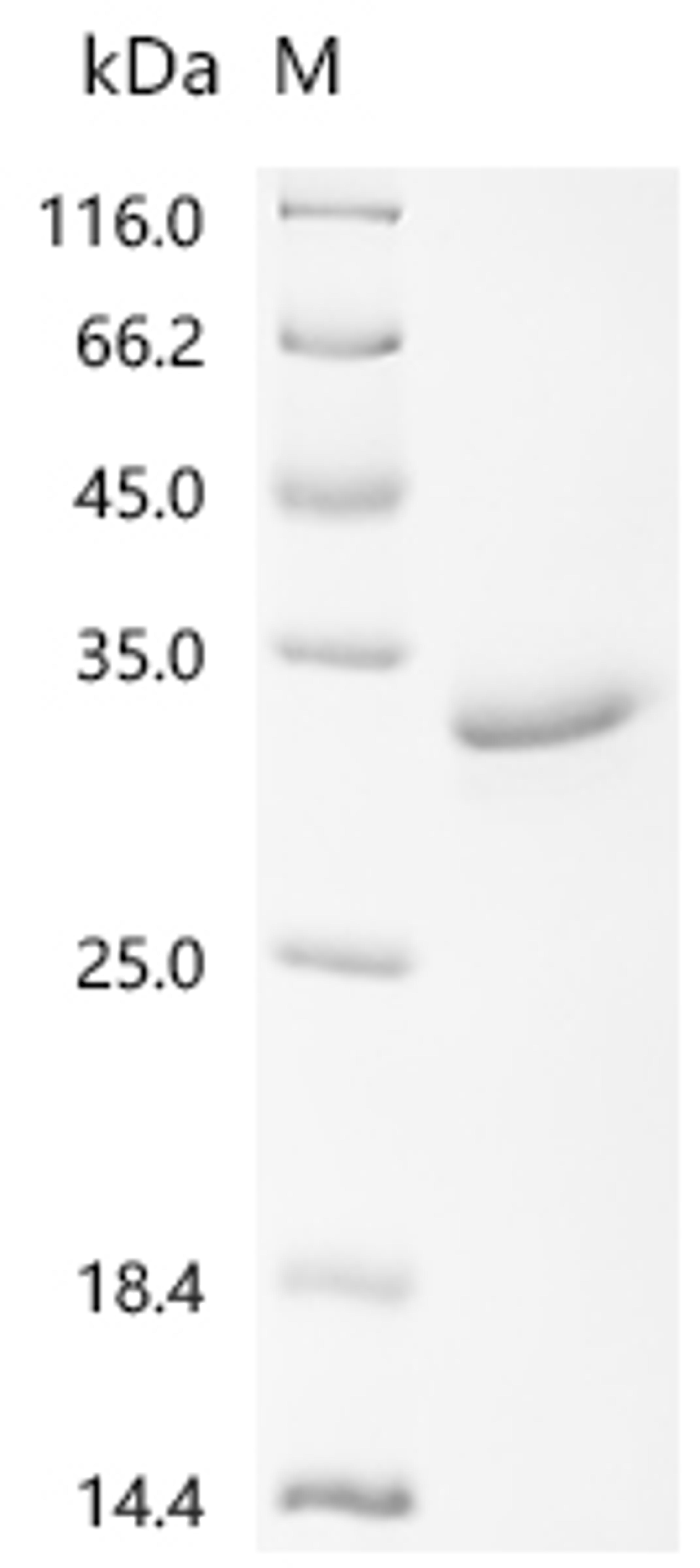 (Tris-Glycine gel) Discontinuous SDS-PAGE (reduced) with 5% enrichment gel and 15% separation gel.