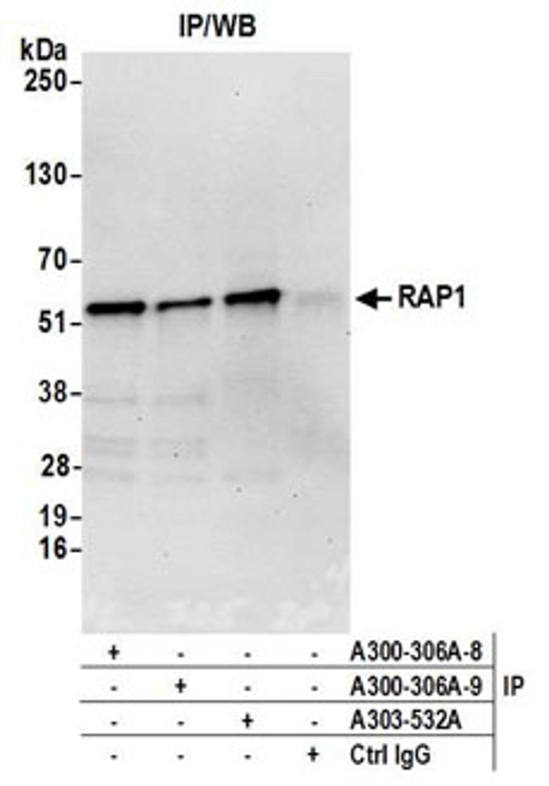 Detection of human RAP1 by western blot of immunoprecipitates.