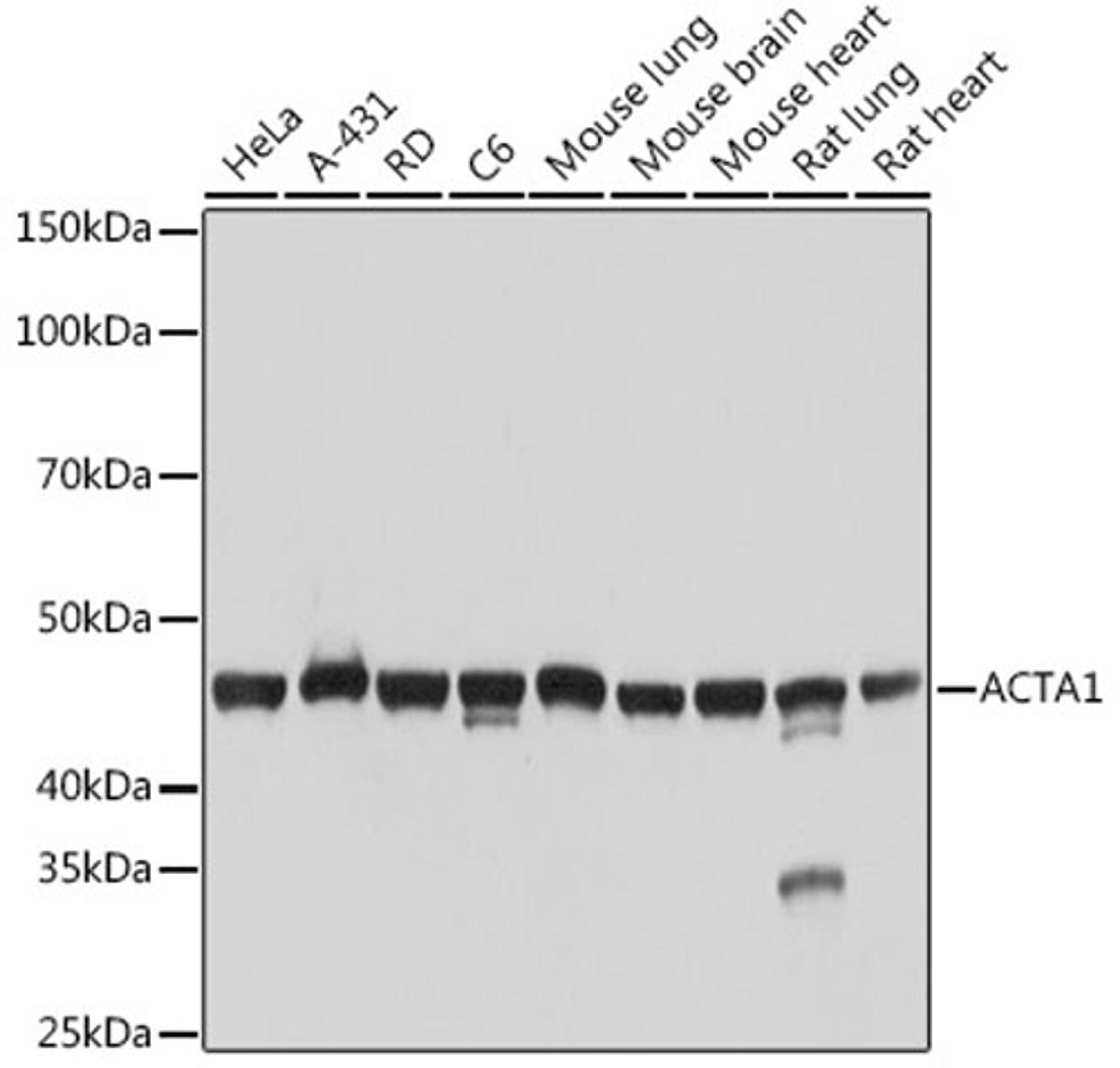 Western blot - ACTA1 Rabbit mAb (A2319)