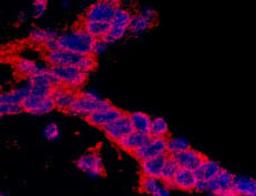 Detection of human CASC3 by immunohistochemistry.