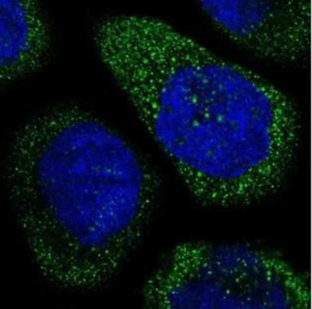 Immunohistochemistry: THSD1 Antibody [NBP1-86930] - staining of human cell line A-431 shows positivity in cytoplasm.