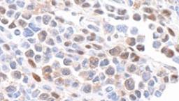 Detection of mouse GAPDH by immunohistochemistry.