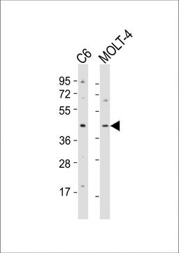 Western Blot at 1:2000 dilution Lane 1: C6 whole cell lysates Lane 2: MOLT-4 whole cell lysates Lysates/proteins at 20 ug per lane.