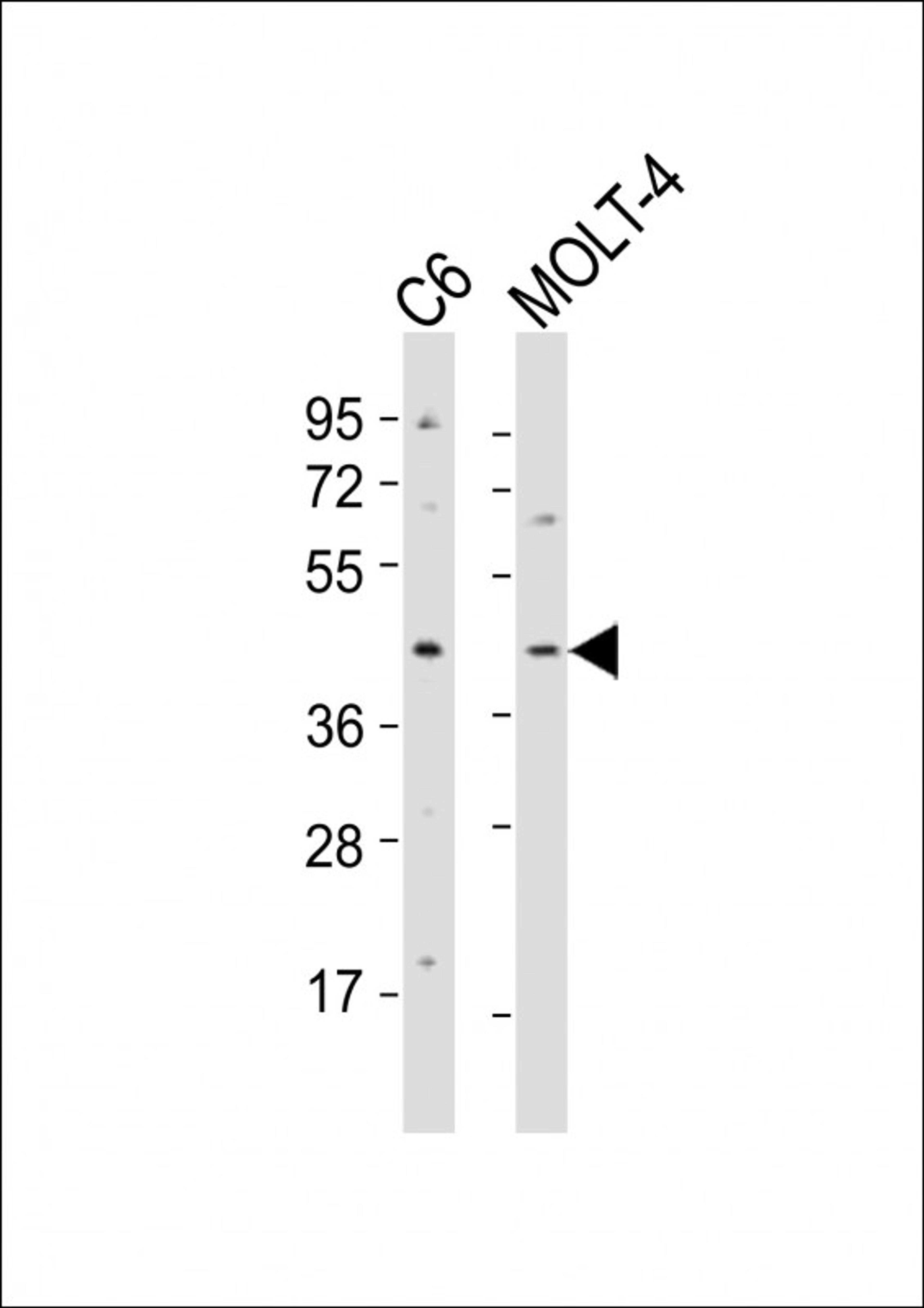 Western Blot at 1:2000 dilution Lane 1: C6 whole cell lysates Lane 2: MOLT-4 whole cell lysates Lysates/proteins at 20 ug per lane.