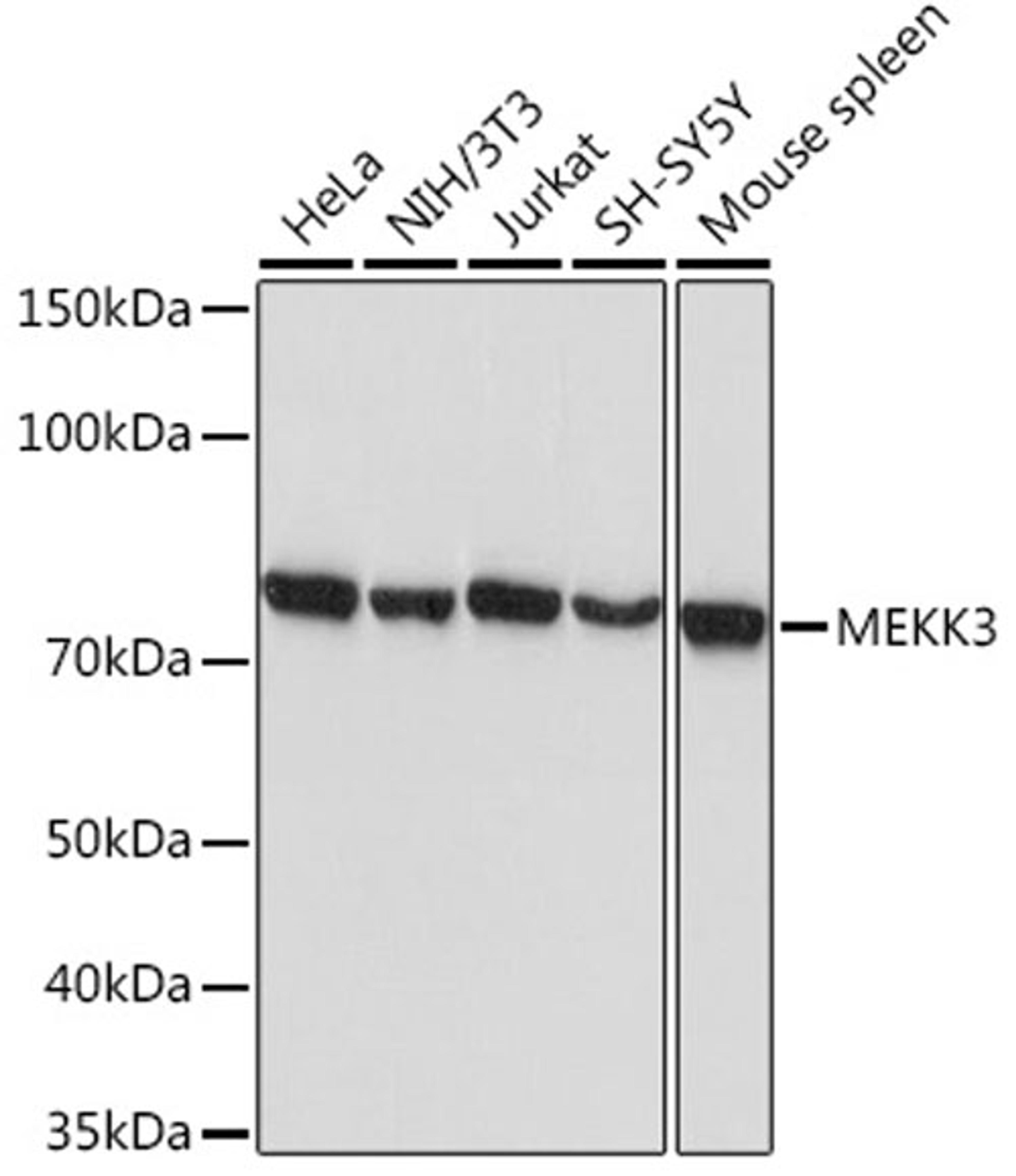 Western blot - MEKK3 Rabbit mAb (A3695)