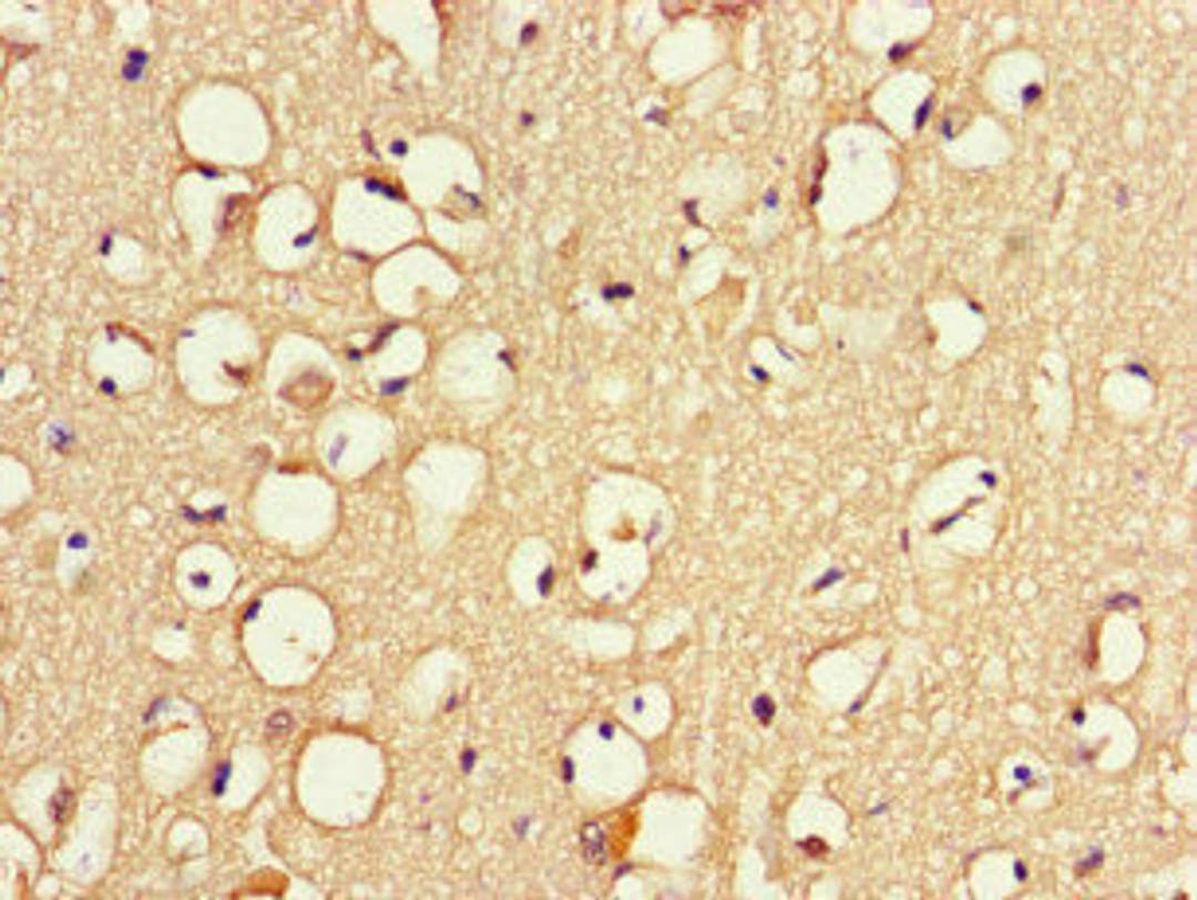 Immunohistochemistry of paraffin-embedded human brain tissue using CSB-PA754628LA01HU at dilution of 1:100