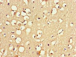 Immunohistochemistry of paraffin-embedded human brain tissue using CSB-PA754628LA01HU at dilution of 1:100