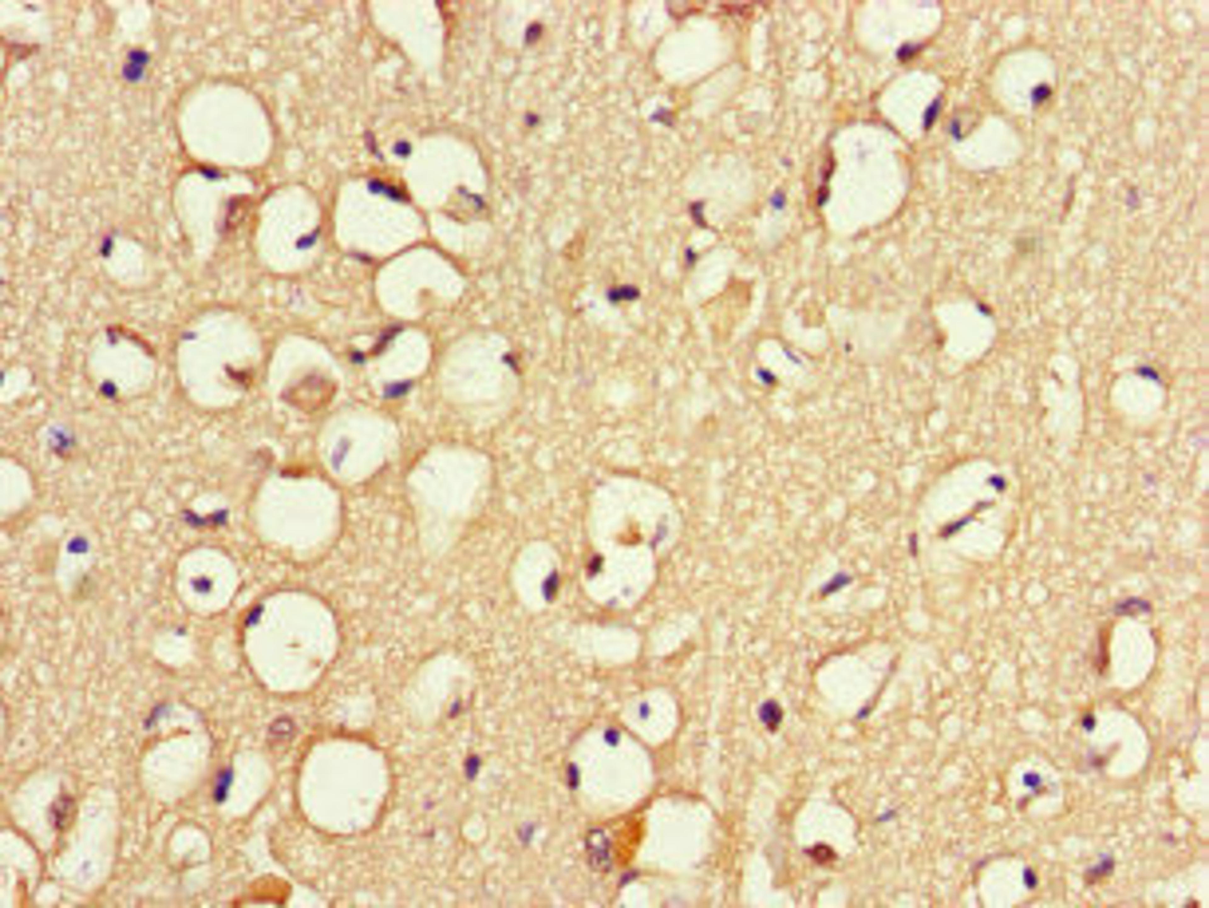 Immunohistochemistry of paraffin-embedded human brain tissue using CSB-PA754628LA01HU at dilution of 1:100