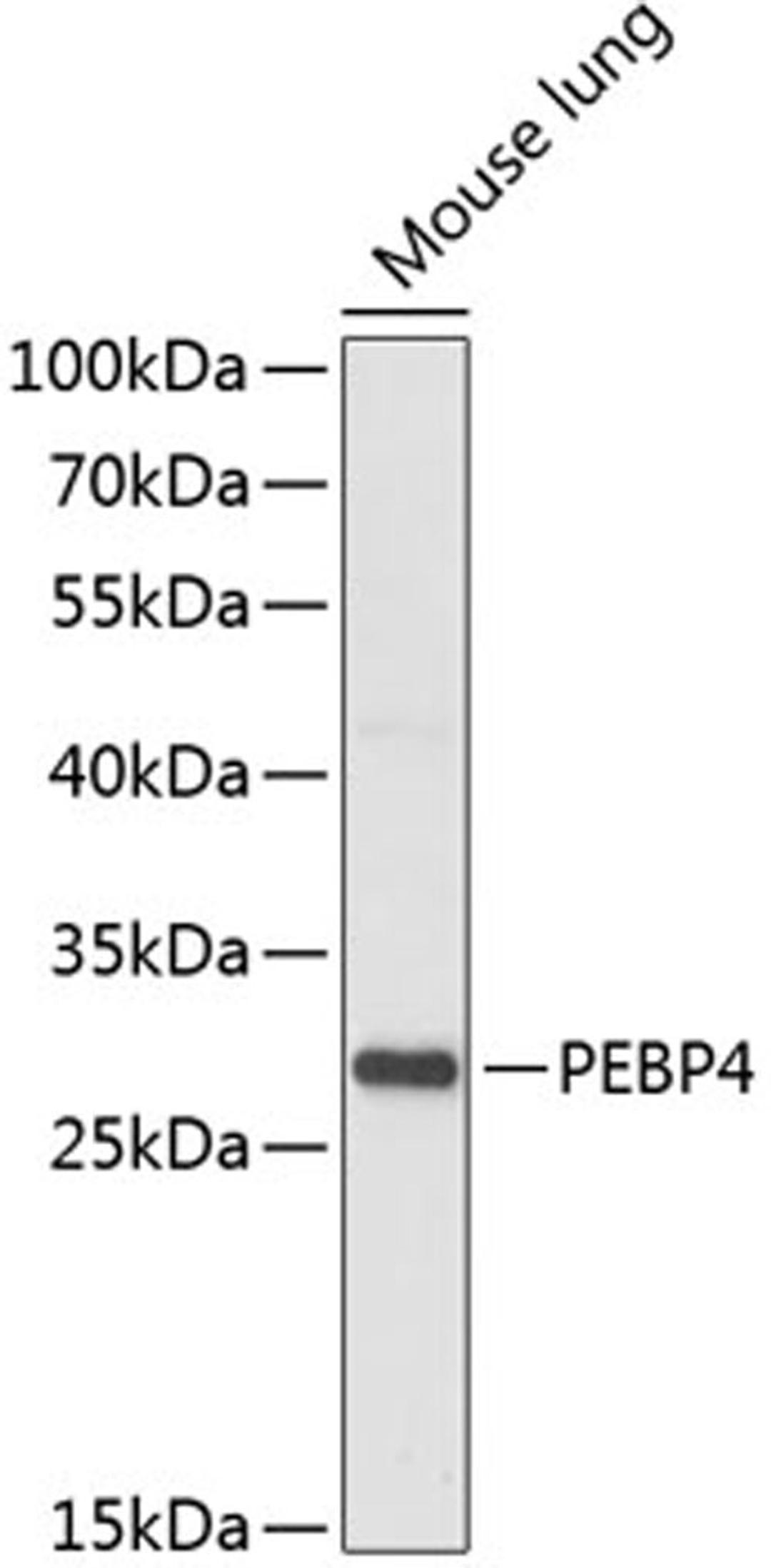 Western blot - PEBP4 antibody (A14485)