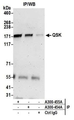 Detection of human QSK by western blot of immunoprecipitates.