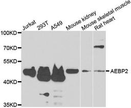 Western blot analysis of extracts of various cell lines using AEBP2 antibody