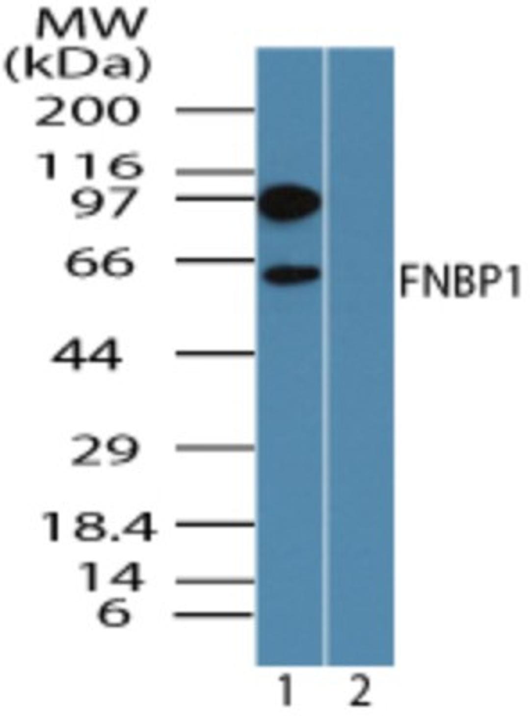 Western Blot: FNBP1 Antibody [NBP2-24526] - analysis of FNBP1 in human liver lysate in the 1) absence and 2) presence of immunizing peptide using FNBP1 antibody at 0.1 ug/ml.