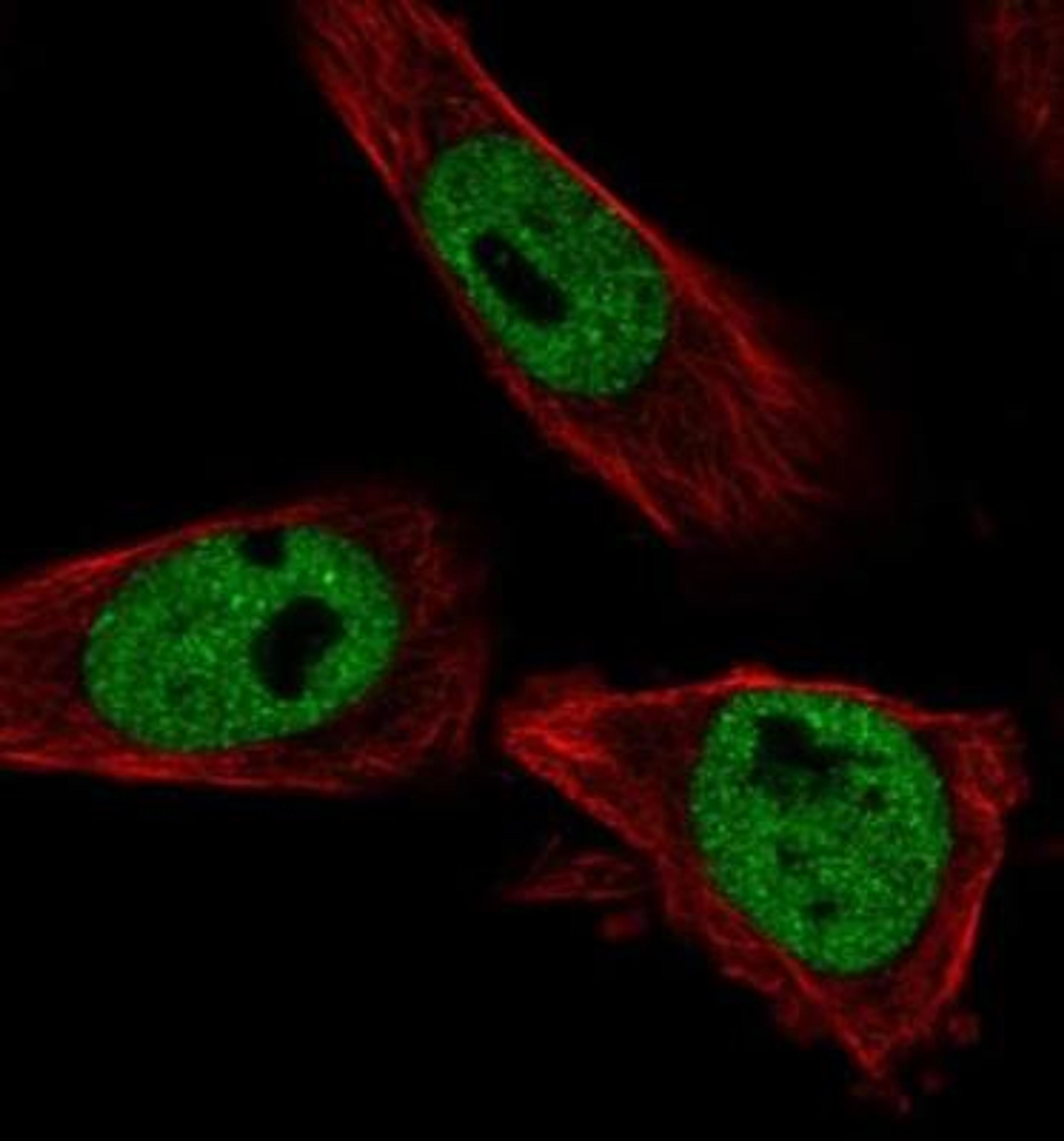 Immunocytochemistry/Immunofluorescence: Regucalcin Antibody [NBP1-80849] - Staining of human cell line U-251 MG shows positivity in nucleus but excluded from the nucleoli. Antibody staining is shown in green.