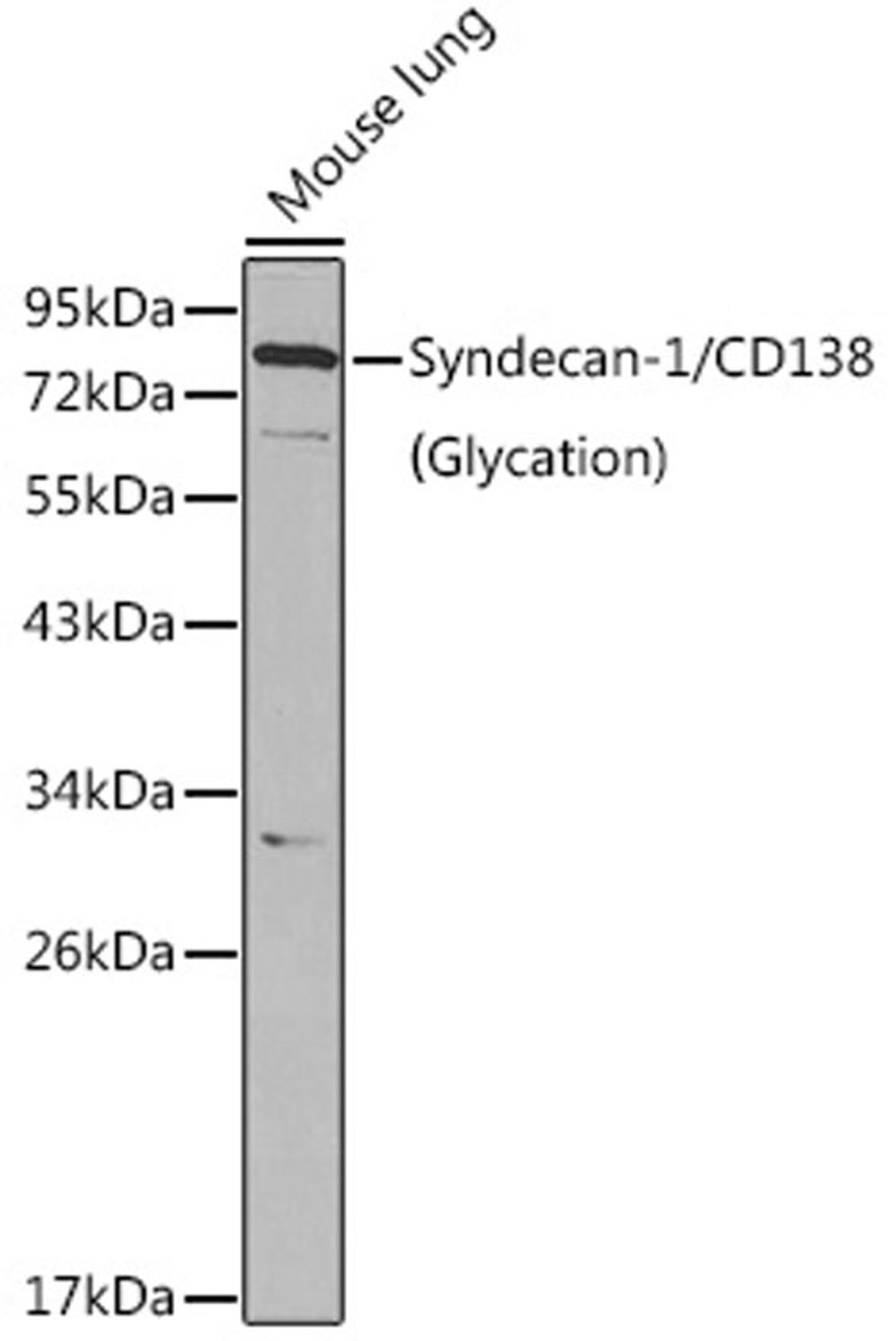 Western blot - Syndecan-1/CD138 antibody (A1235)