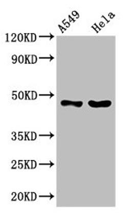 Western Blot. Positive WB detected in: A549 whole cell lysate, Hela whole cell lysate. All lanes: SLC16A11 antibody at 3.8µg/ml. Secondary. Goat polyclonal to rabbit IgG at 1/50000 dilution. Predicted band size: 48 kDa. Observed band size: 48 kDa