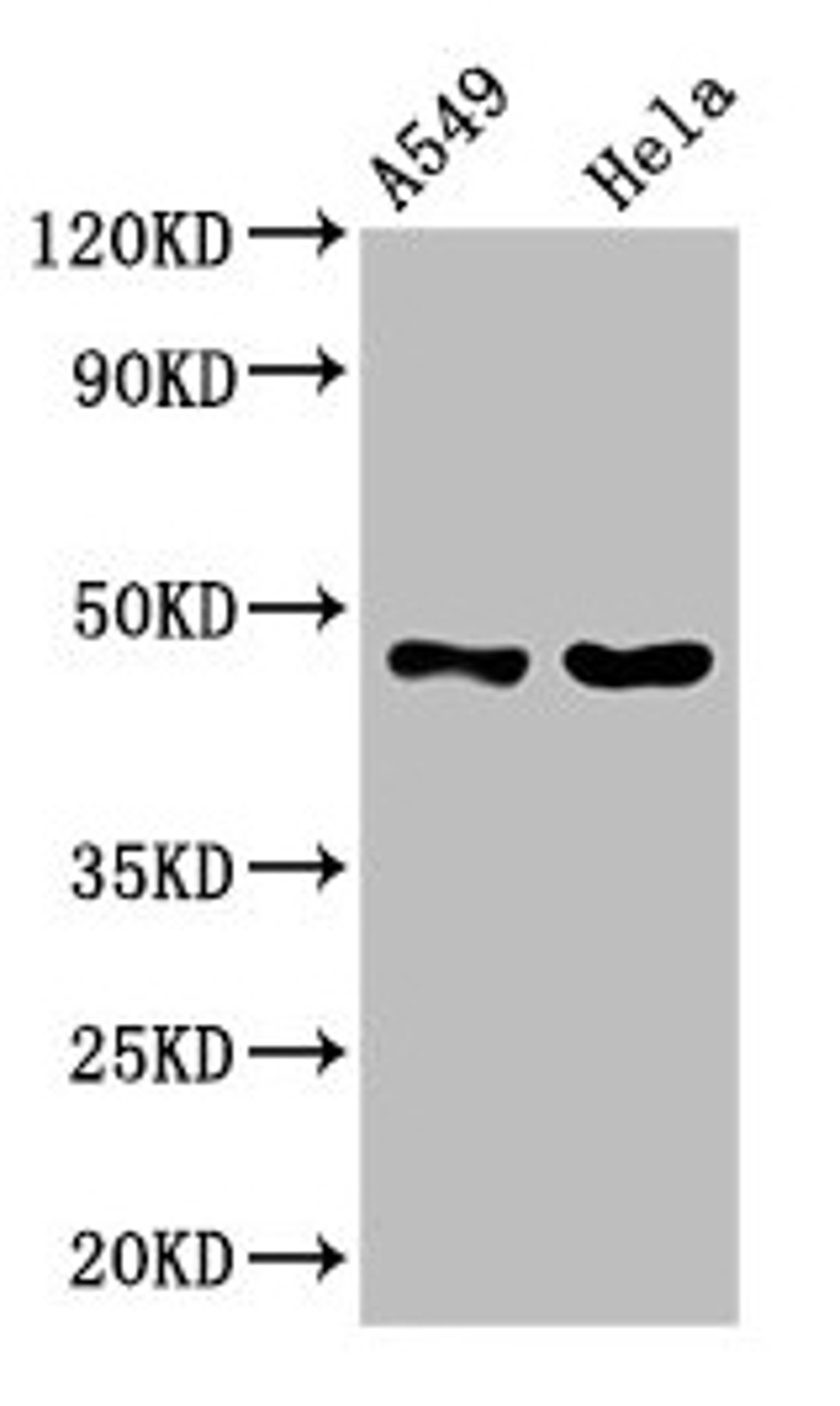 Western Blot. Positive WB detected in: A549 whole cell lysate, Hela whole cell lysate. All lanes: SLC16A11 antibody at 3.8µg/ml. Secondary. Goat polyclonal to rabbit IgG at 1/50000 dilution. Predicted band size: 48 kDa. Observed band size: 48 kDa