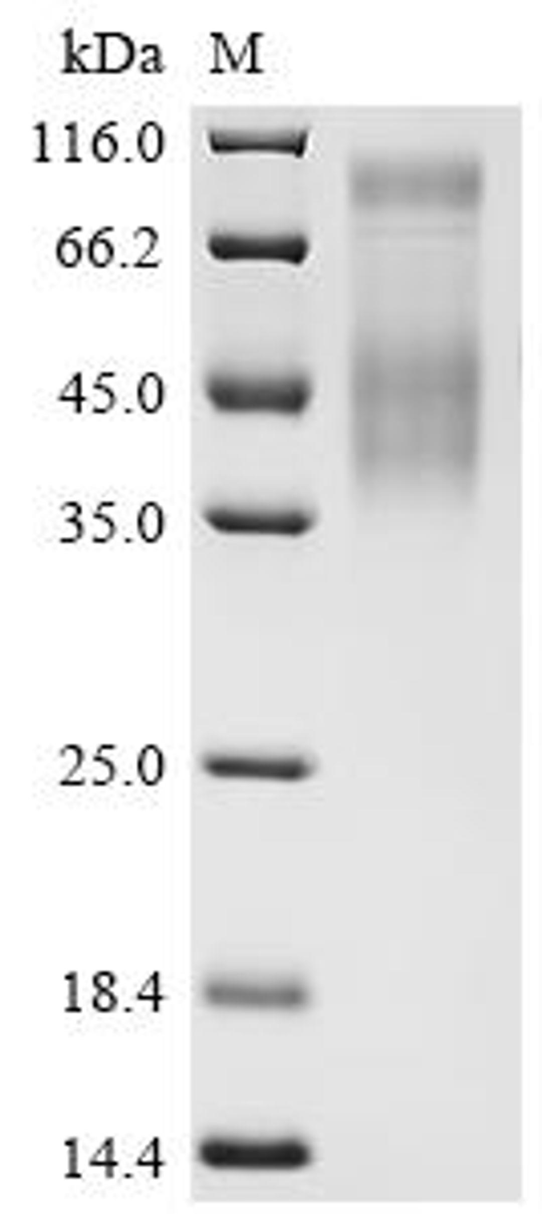 (Tris-Glycine gel) Discontinuous SDS-PAGE (reduced) with 5% enrichment gel and 15% separation gel.