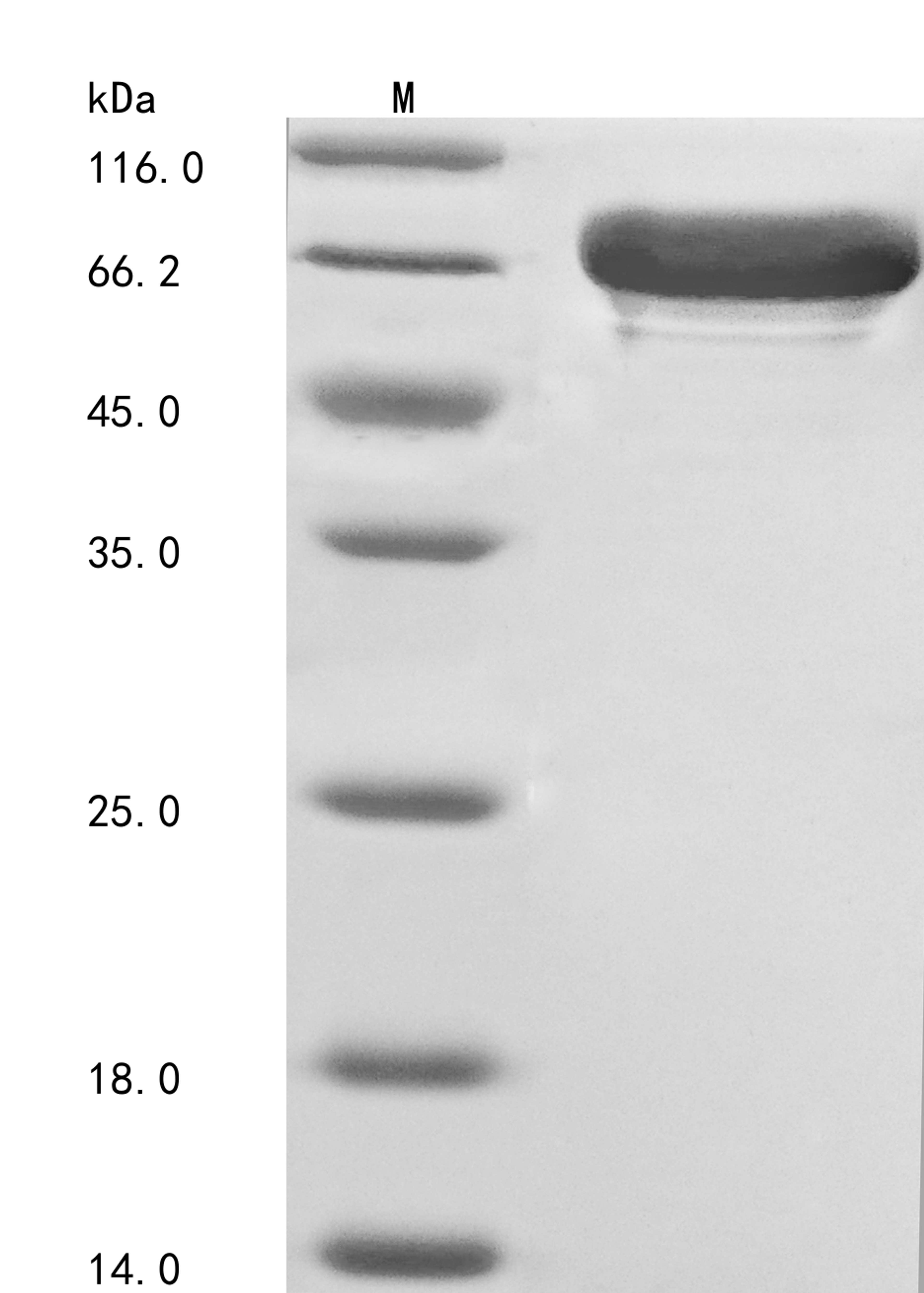 (Tris-Glycine gel) Discontinuous SDS-PAGE (reduced) with 5% enrichment gel and 15% separation gel.