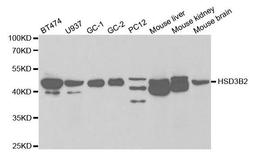 Western blot analysis of extracts of various cell lines using HSD3B2 antibody