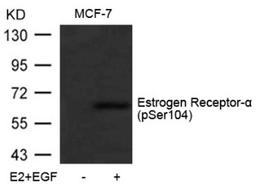 Western blot analysis of lysed extracts from MCF-7 cells untreated or treated with E2 and EGF using Estrogen Receptor-&#945; (Phospho-Ser104).