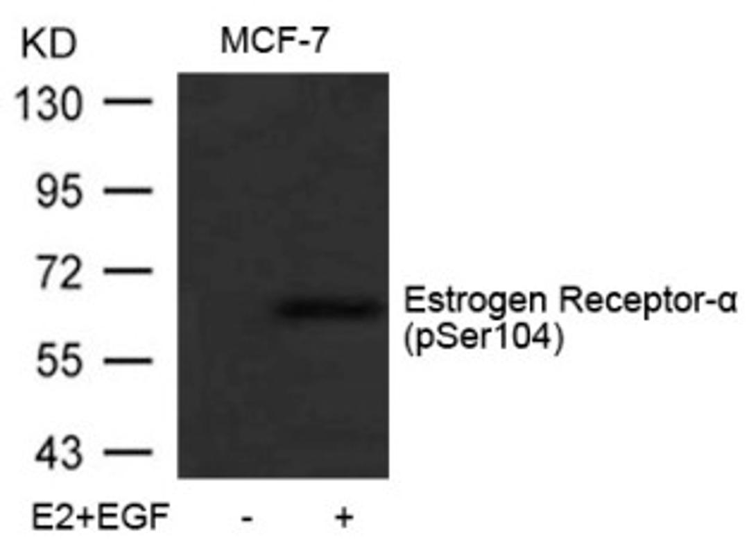 Western blot analysis of lysed extracts from MCF-7 cells untreated or treated with E2 and EGF using Estrogen Receptor-α (Phospho-Ser104).