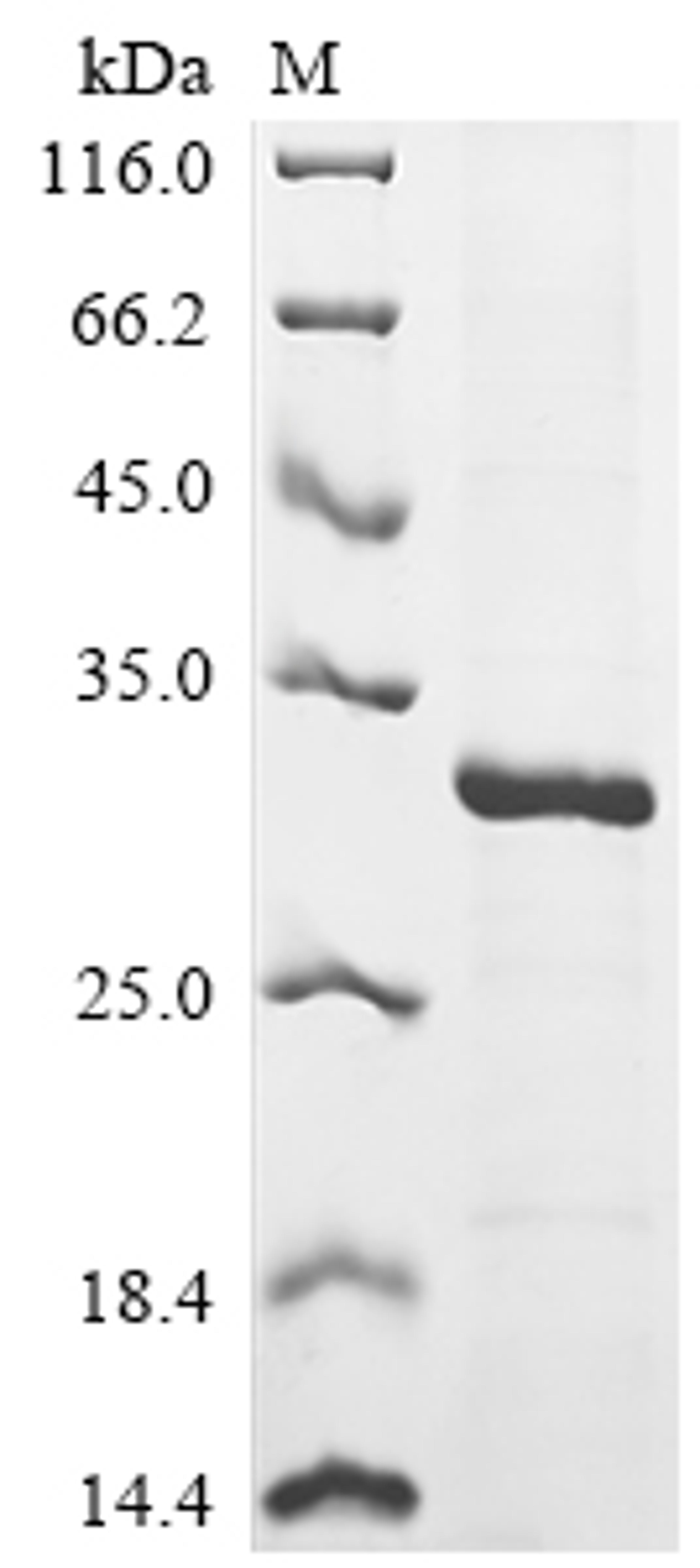 (Tris-Glycine gel) Discontinuous SDS-PAGE (reduced) with 5% enrichment gel and 15% separation gel.
