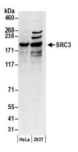 Detection of human SRC3 by western blot.