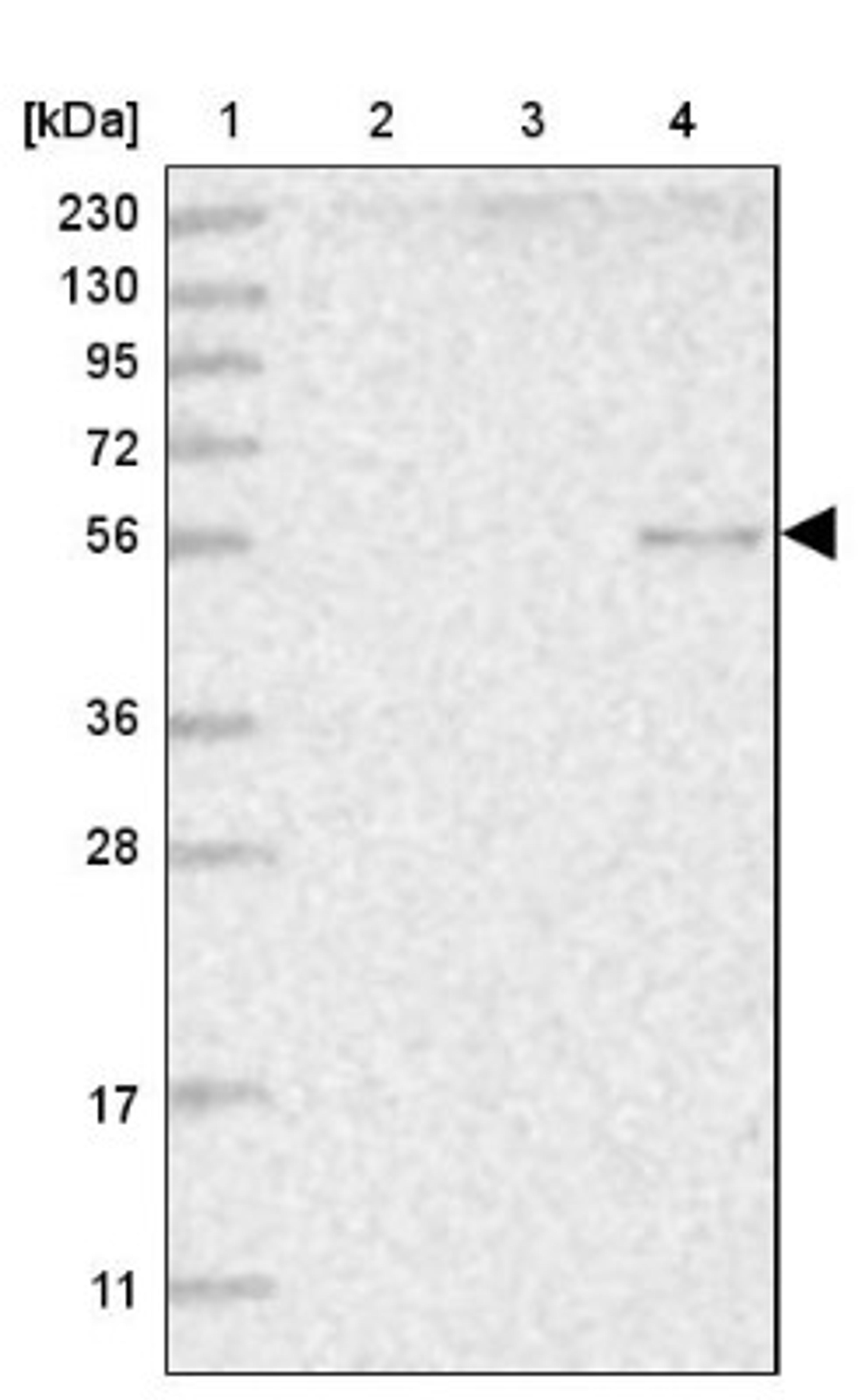 Western Blot: HYAL2 Antibody [NBP1-81283] - Lane 1: Marker [kDa] 230, 130, 95, 72, 56, 36, 28, 17, 11<br/>Lane 2: Human cell line RT-4<br/>Lane 3: Human cell line U-251MG sp<br/>Lane 4: Human plasma (IgG/HSA depleted)