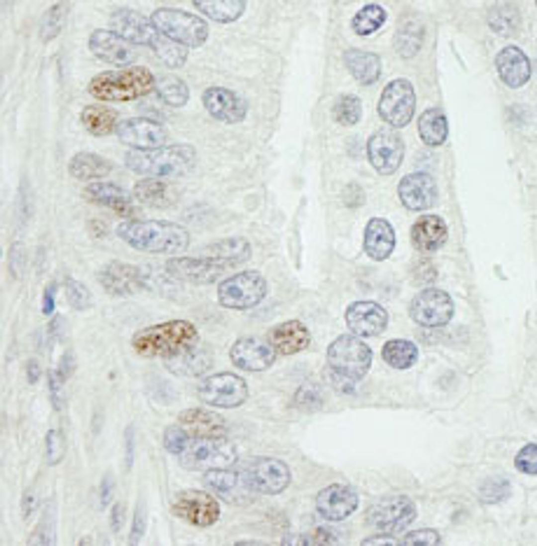 Detection of human MED18 by immunohistochemistry.