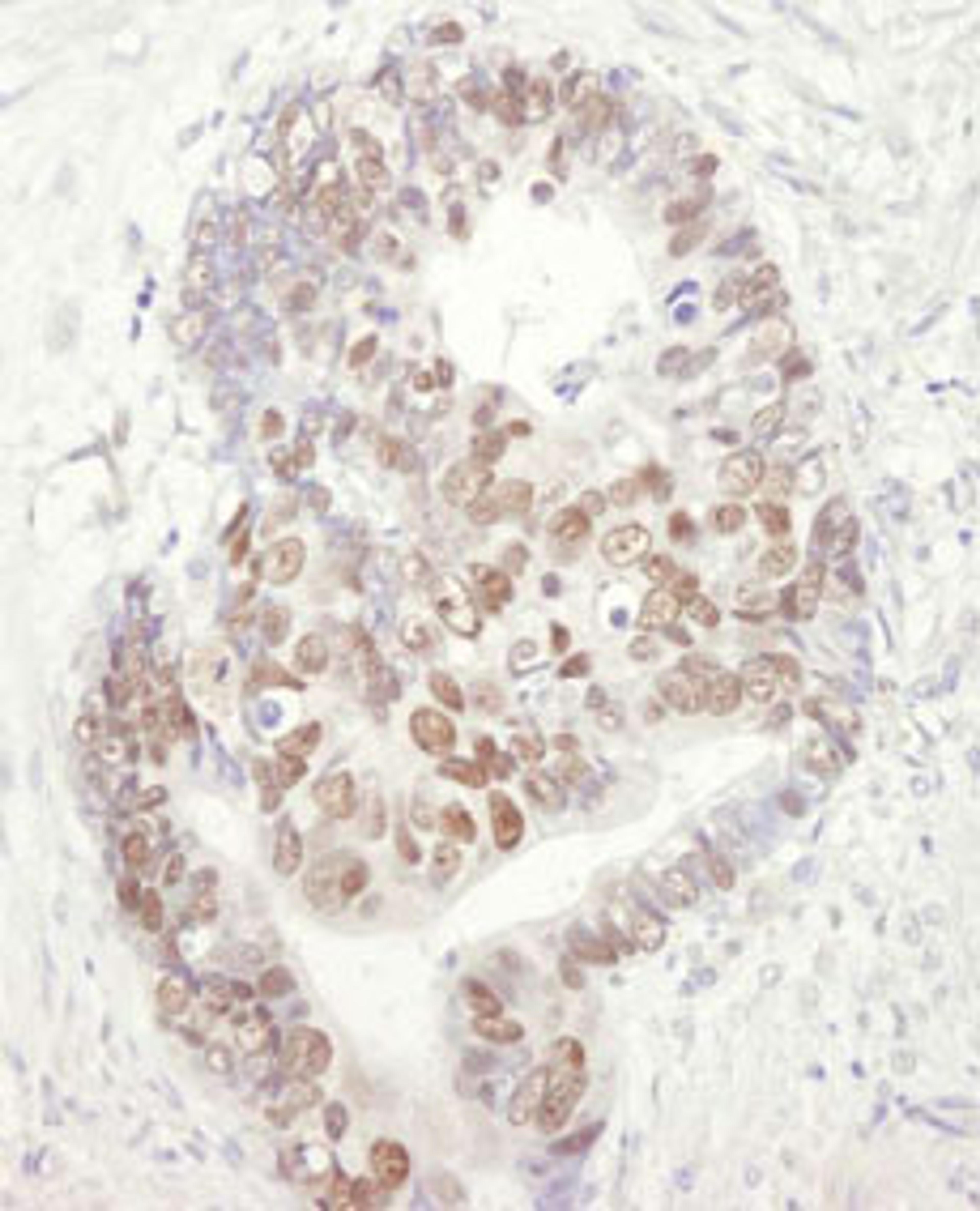 Detection of human MCM3 by immunohistochemistry.