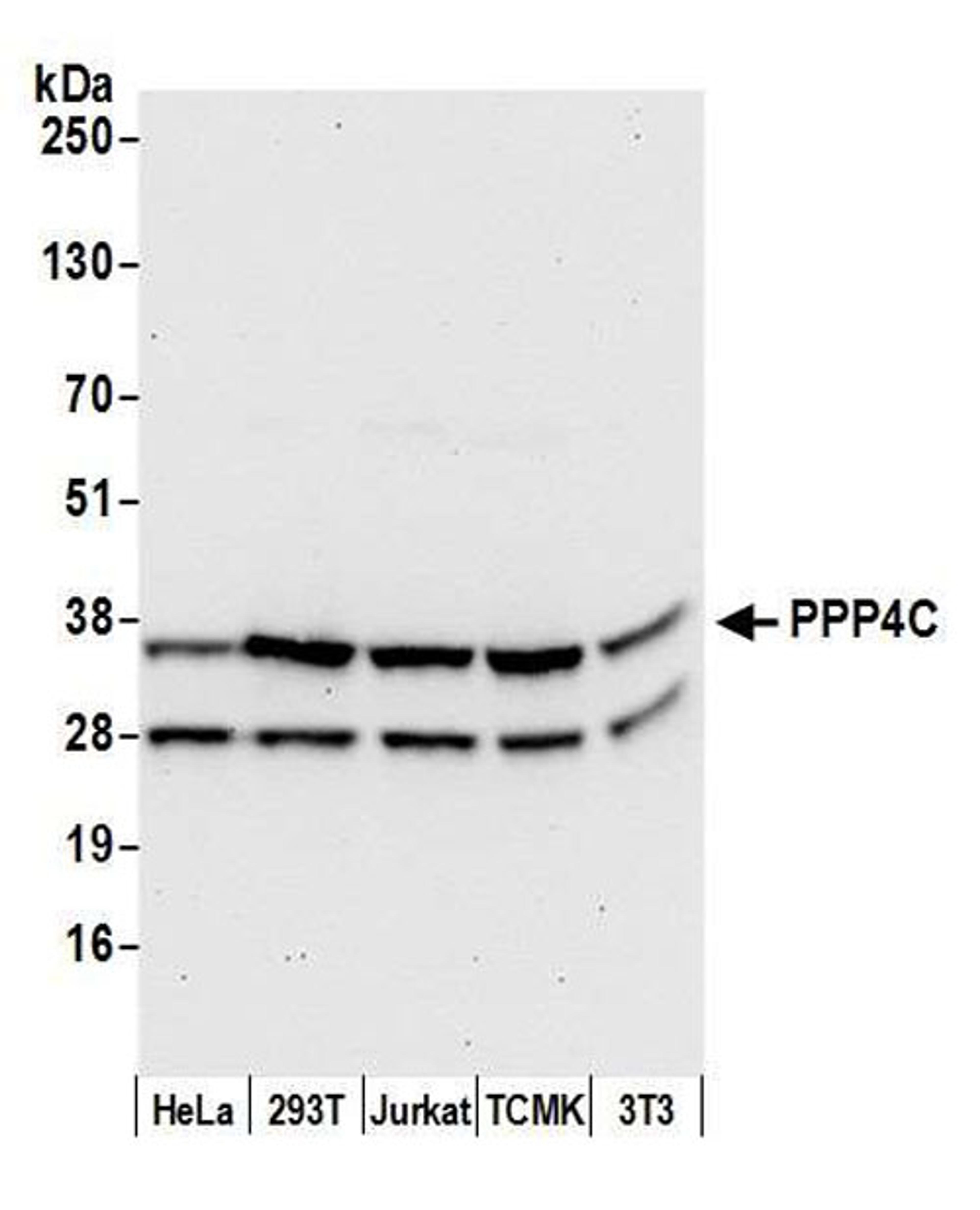 Detection of human and mouse PPP4C by WB.