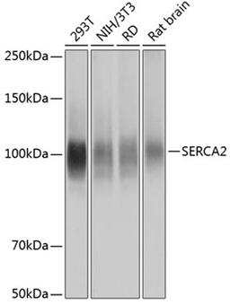 Western blot - SERCA2 Rabbit mAb (A11692)