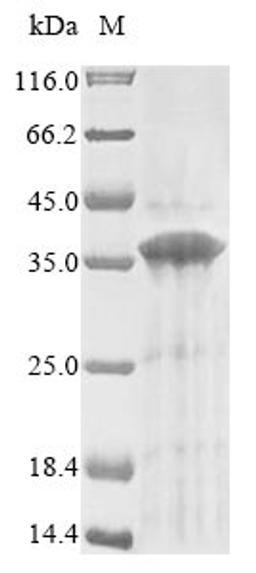 (Tris-Glycine gel) Discontinuous SDS-PAGE (reduced) with 5% enrichment gel and 15% separation gel.