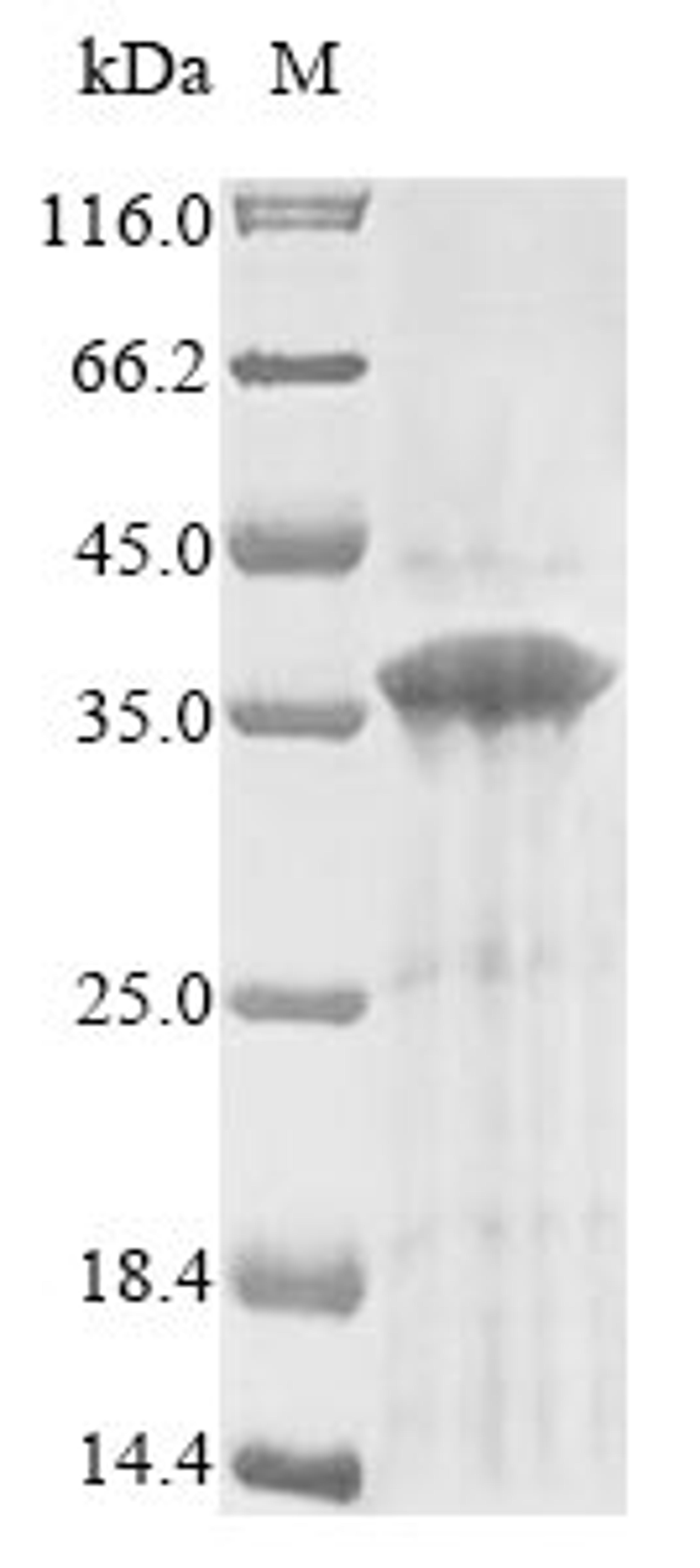 (Tris-Glycine gel) Discontinuous SDS-PAGE (reduced) with 5% enrichment gel and 15% separation gel.