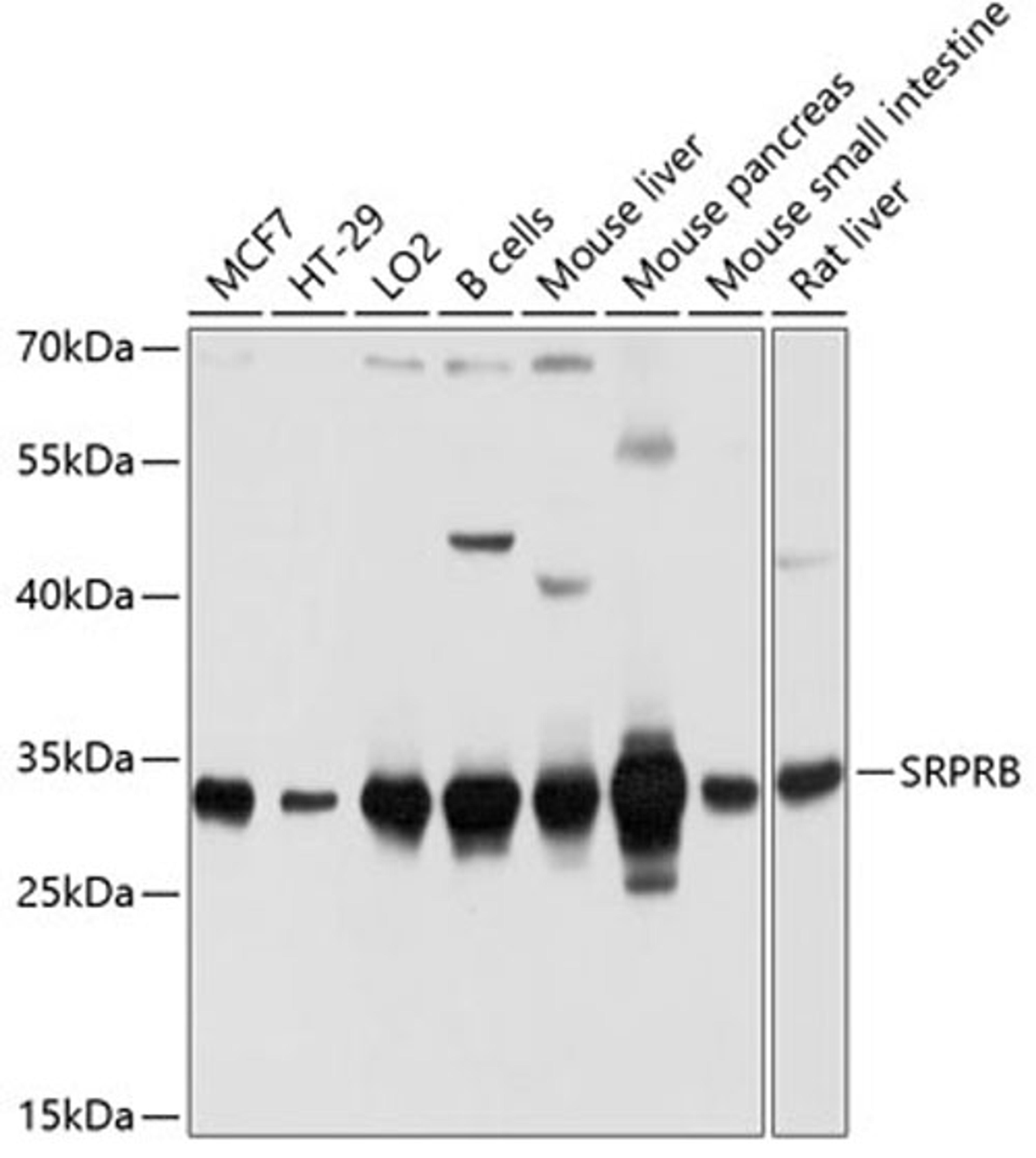 Western blot - SRPRB antibody (A10591)